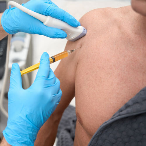 Médico especialista realizando biópsia (amostragem do ombro do paciente)