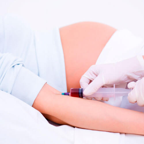 Mulher grávida realizando o exame de sexagem fetal Mulher grávida realizando o exame de sexagem fetal