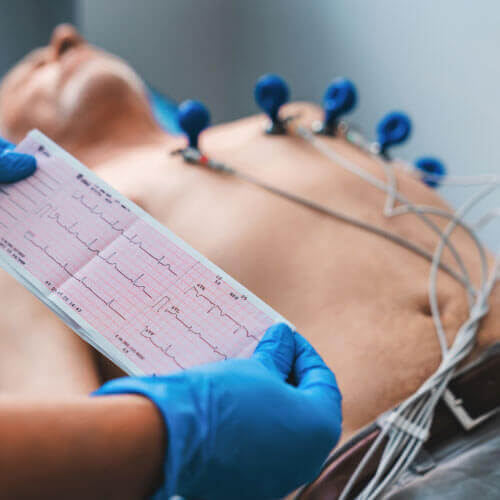 Homem realizando Eletrocardiograma na Global exames Homem realizando Eletrocardiograma na Global exames