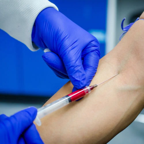 Exame de Dosagem de hormônios da tireoide (TSH e tiroxina)