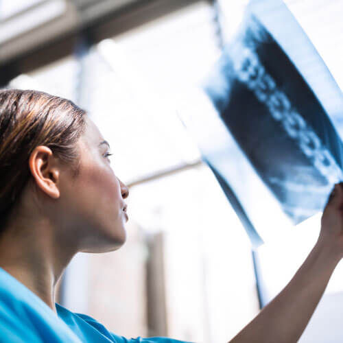 Enfermeira examinando relatório de raio-x-em-guarulhos