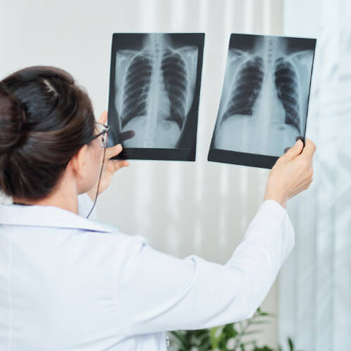 Médico verificando exame de raio-x-em-guarulhos