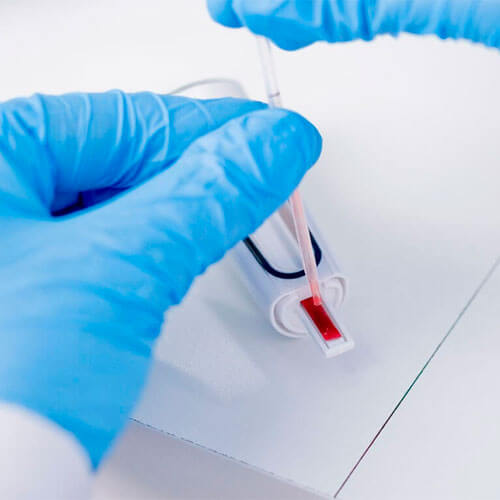 Exame de Dosagem de Anticorpos